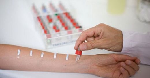 Alerji Kaşıntı Kızarıklık Belirtileri ve Tedavisi