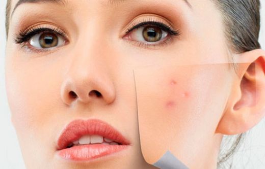 Kızarıklık Kremi Kullanımı ve Faydaları Nelerdir?